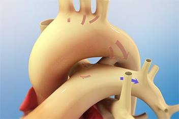 Heart Animation Teaser