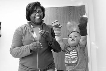 Nurse blowing bubbles for burn patient