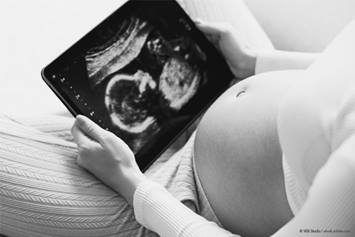 pregnant woman holding an ultrasound picture