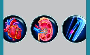 Childhood Kidney Stones