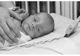 NICU baby in isolette
