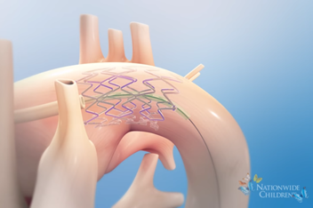 Animation: Hybrid Stage 1